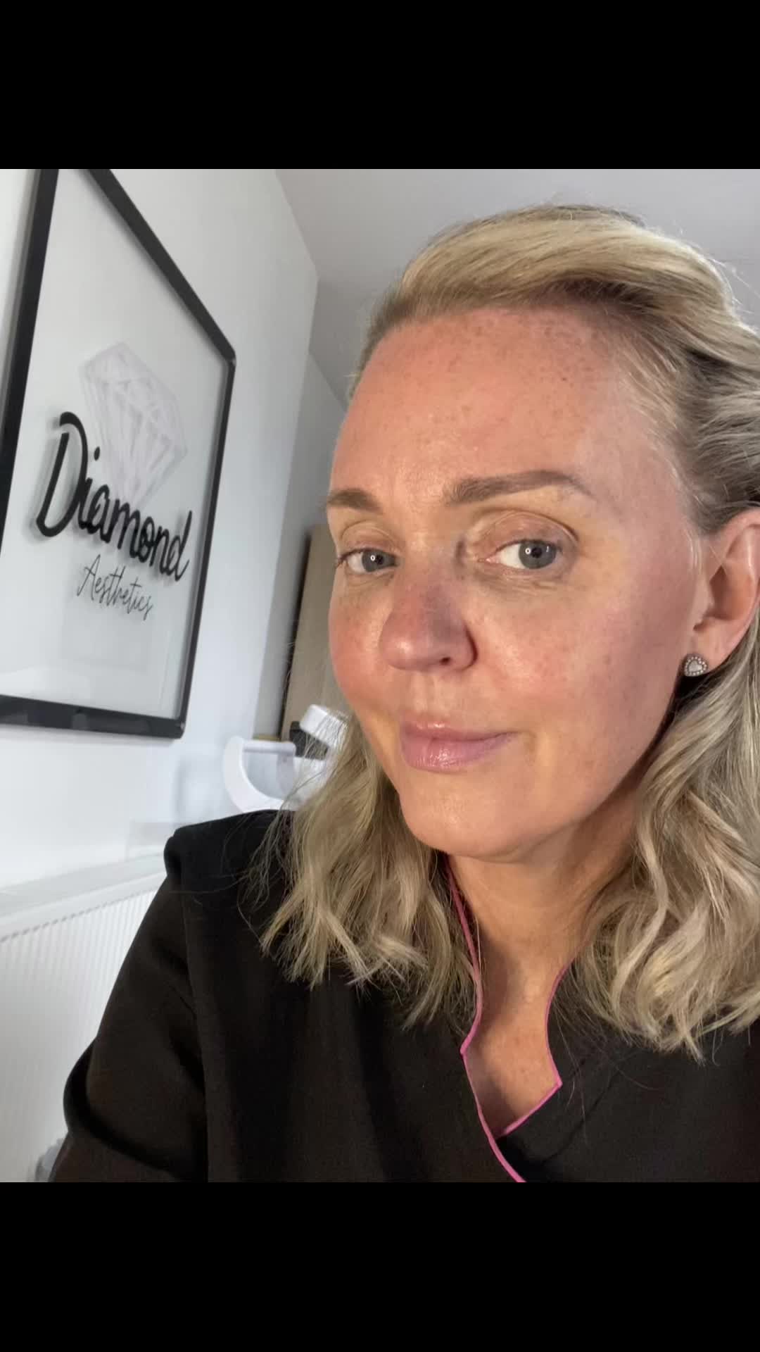 @Diamond Aesthetics Barnsley