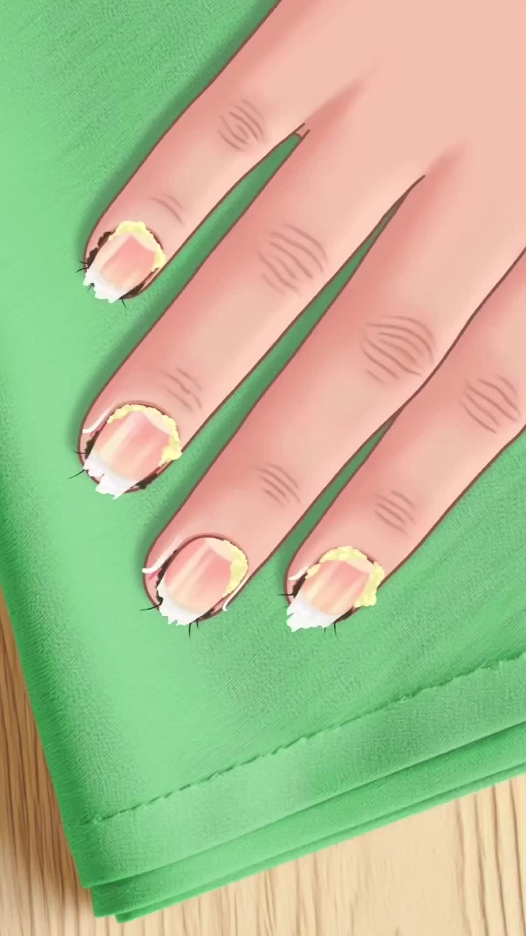 @Clamfimd86