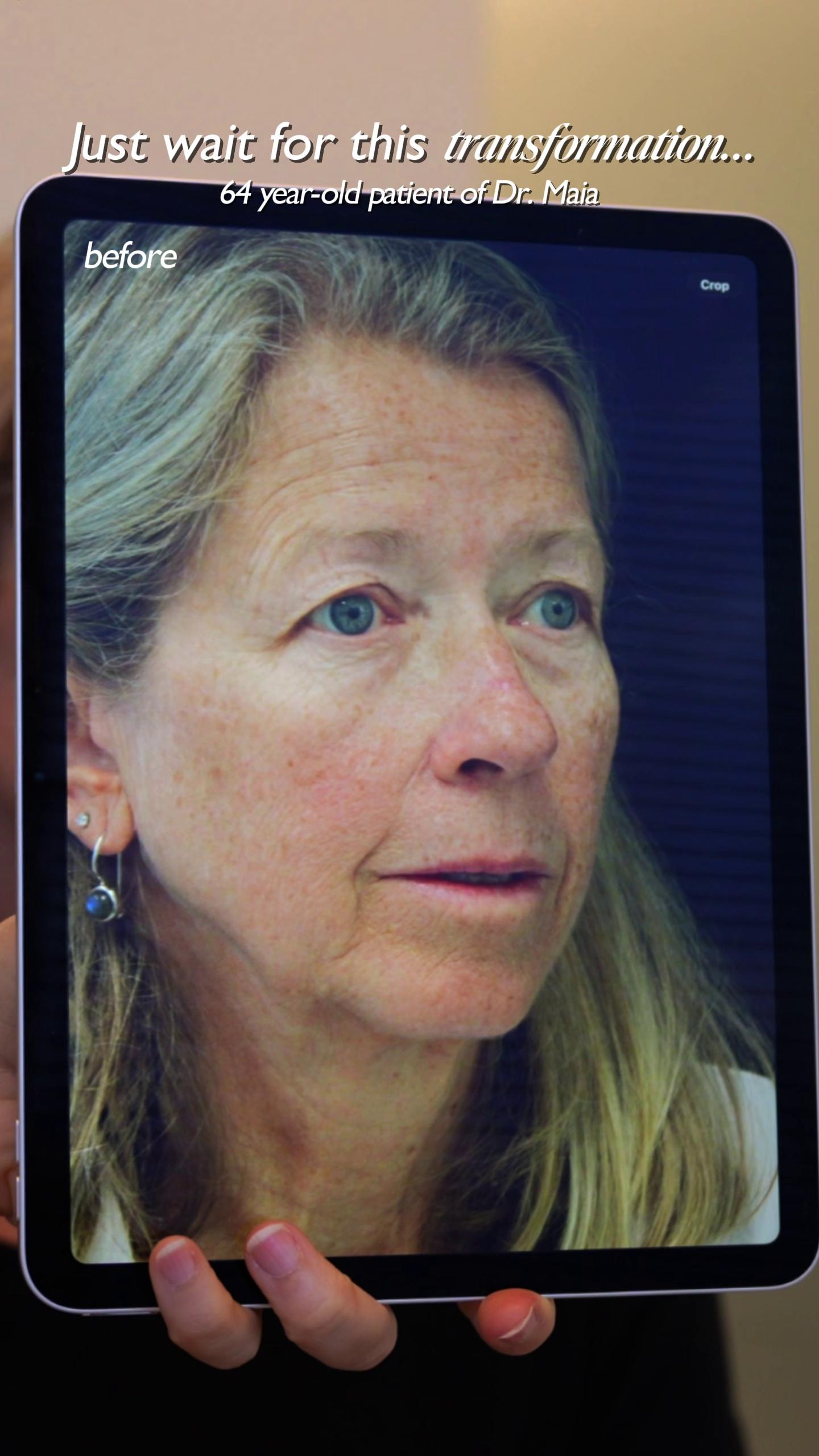 @Dr. Maia | Plastic Surgeon