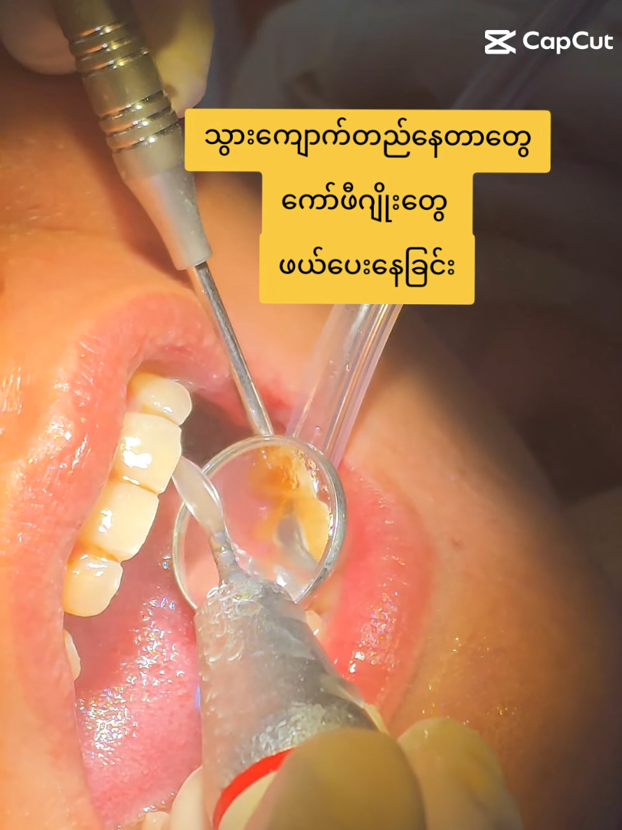 @Phyu OM