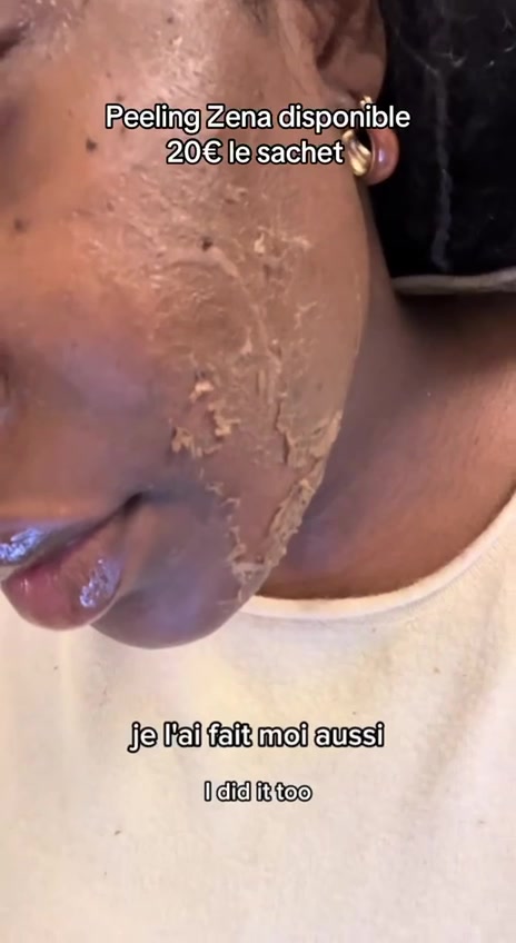 @peeling_zena