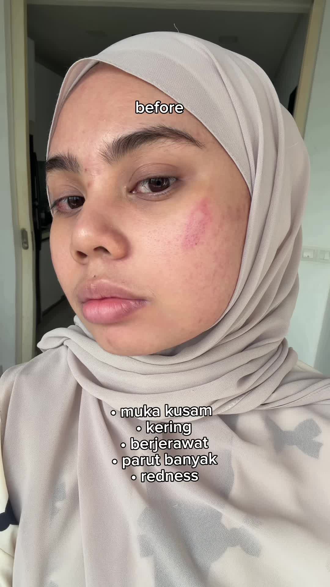 @aini.asyiqinn