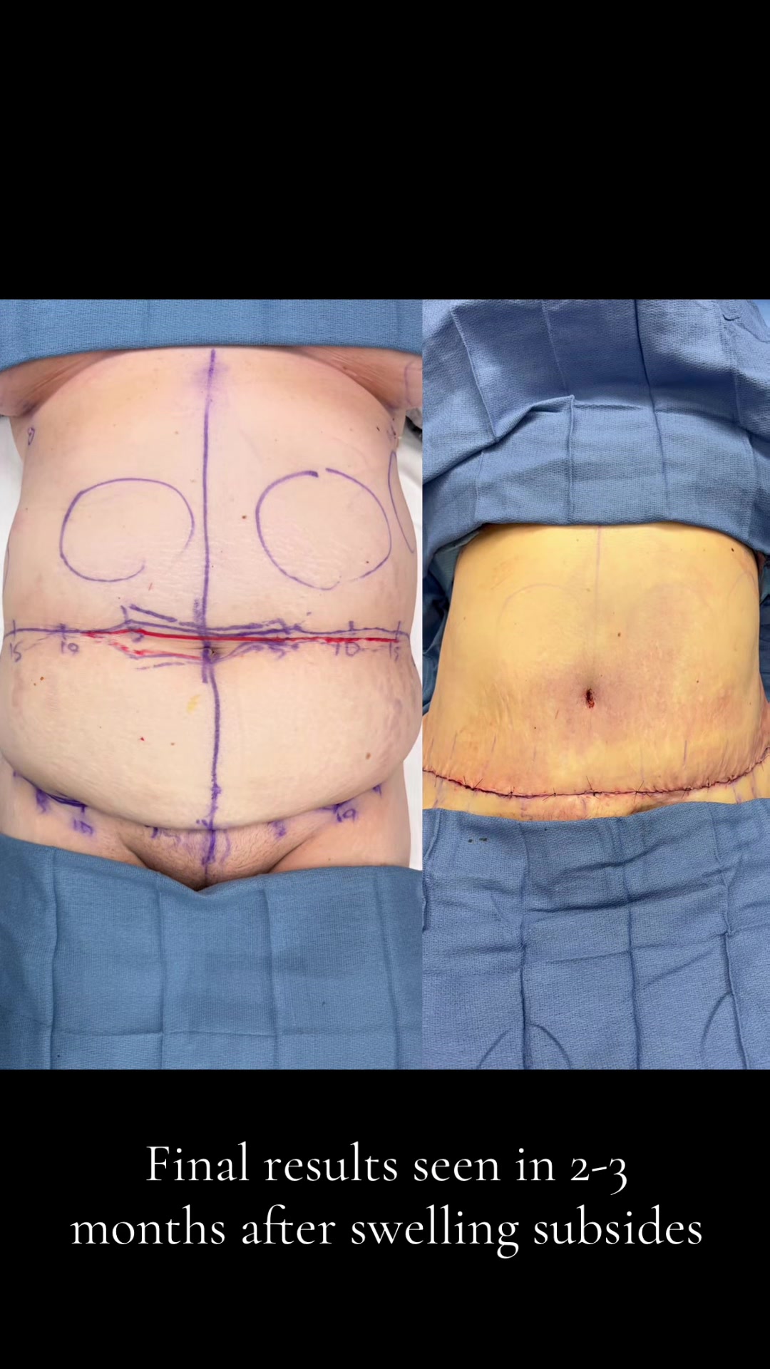 @AESTHETICA LA -Dr.Yaghoubian