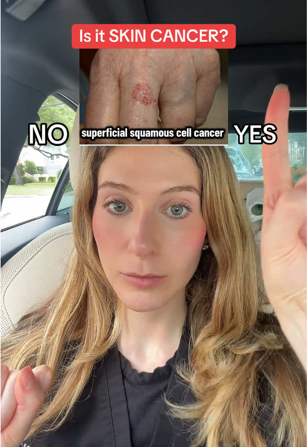 @Heather Kornmehl, MD