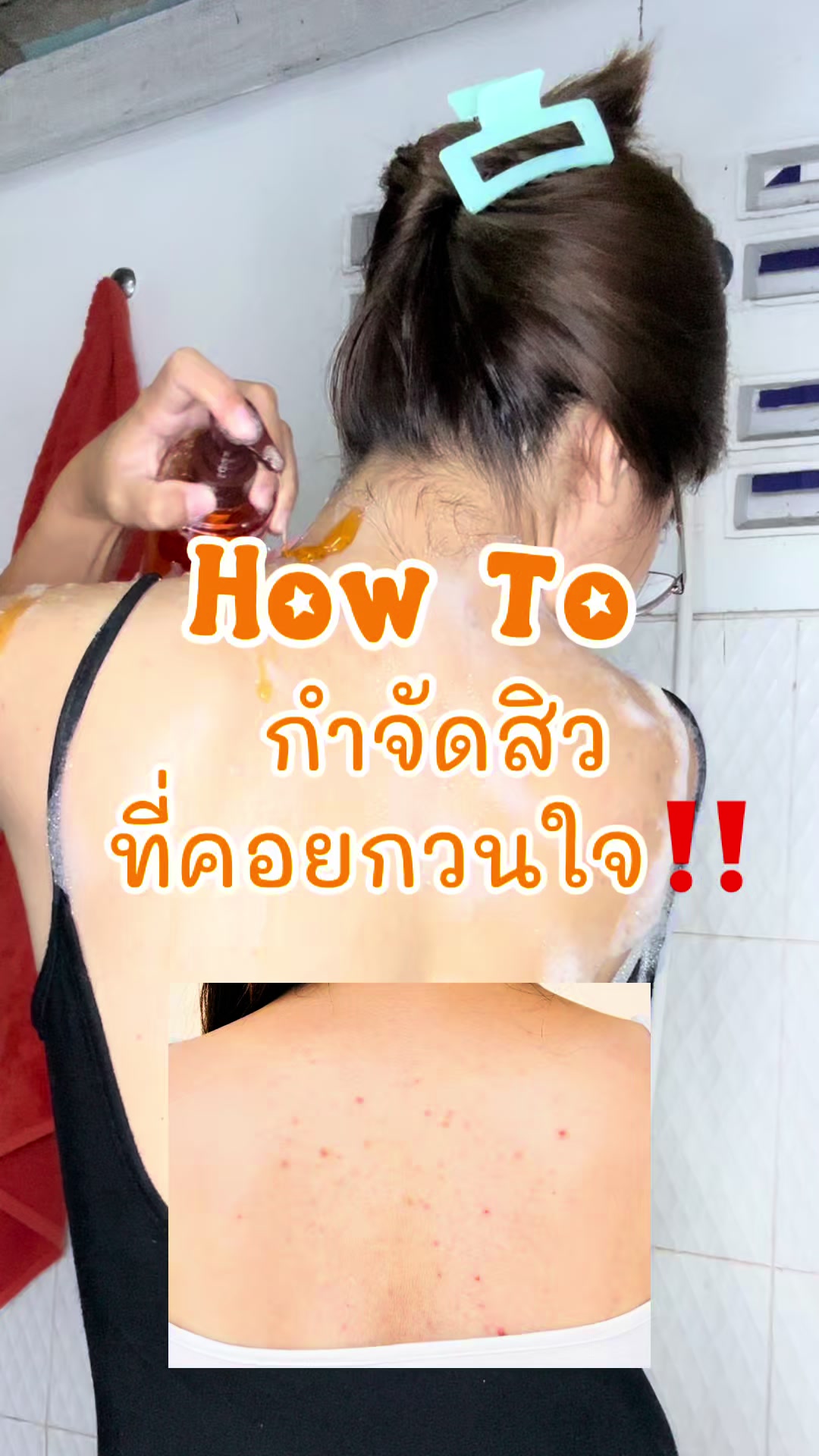 @โอนิอยากไป 🍒
