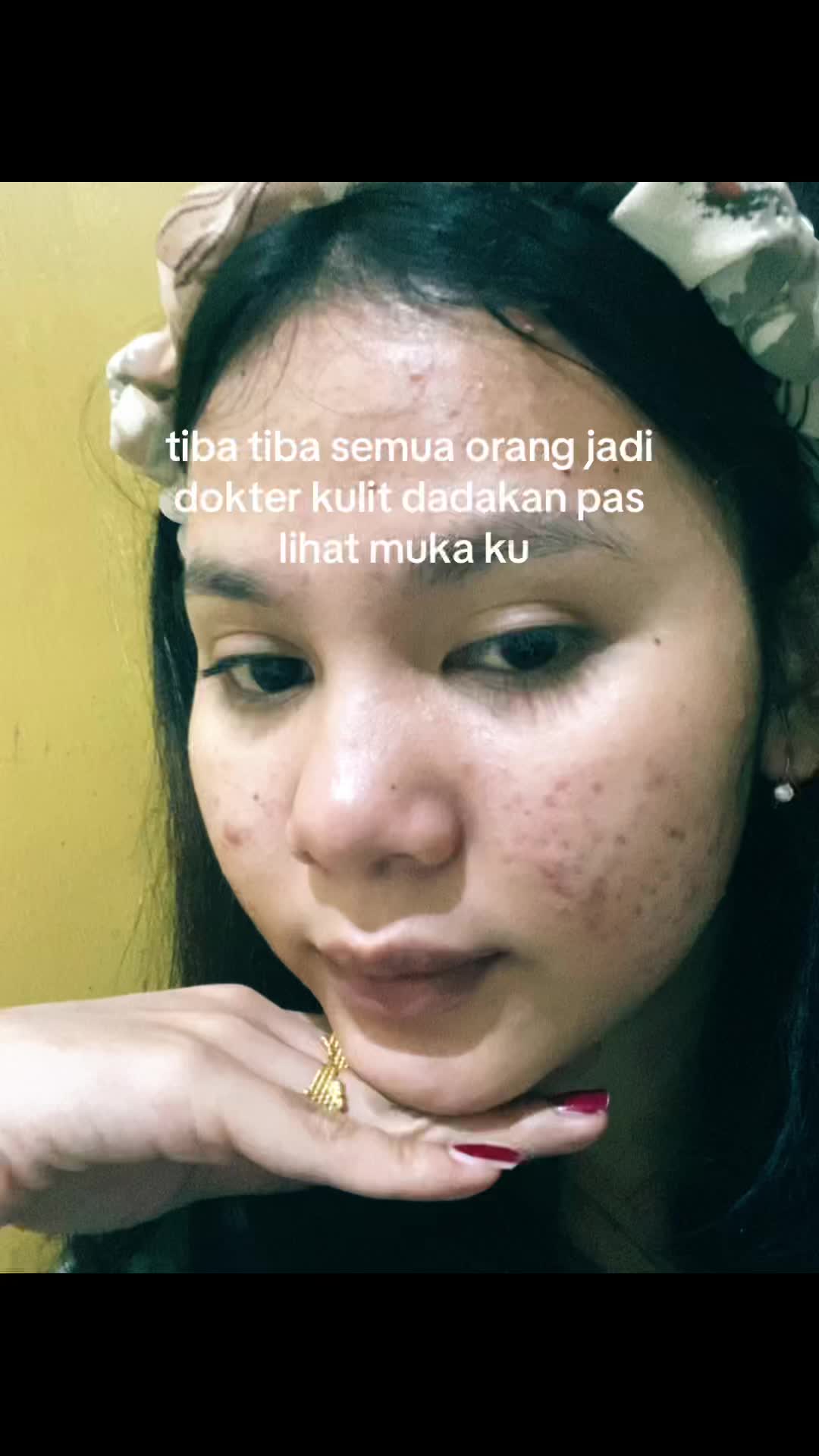 @Natha | Acne fighter