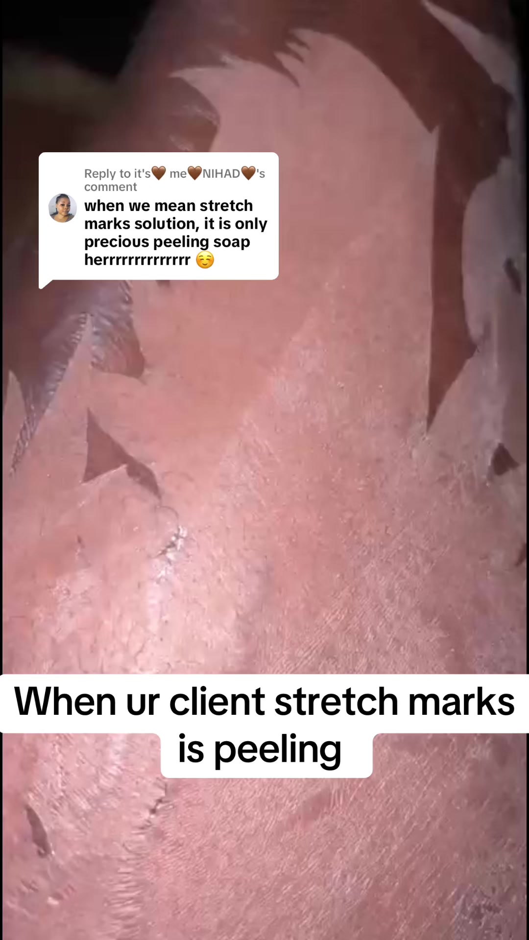 @@ Precious peeling soap