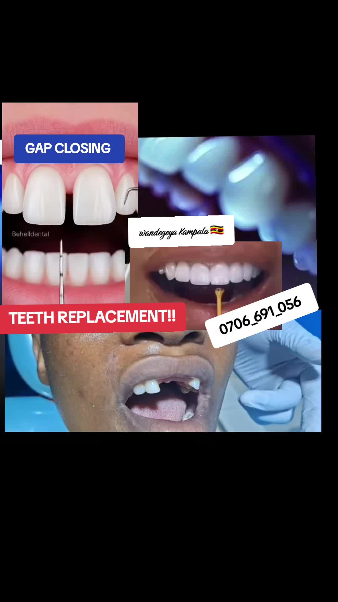 @Dental studio.🦷.Kampala