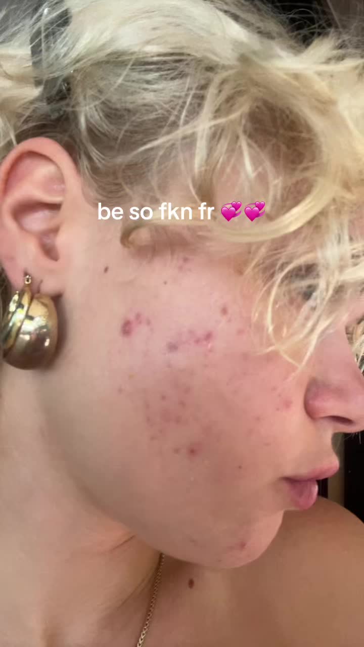 @jorlind