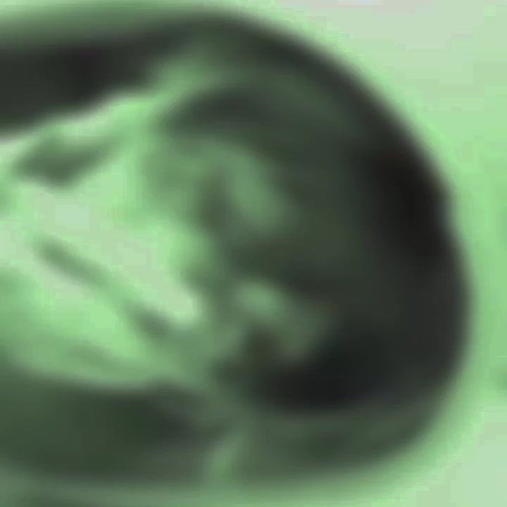 @𝕬𝖑𝖆𝖘𝕽𝖔𝖙𝖆𝖘