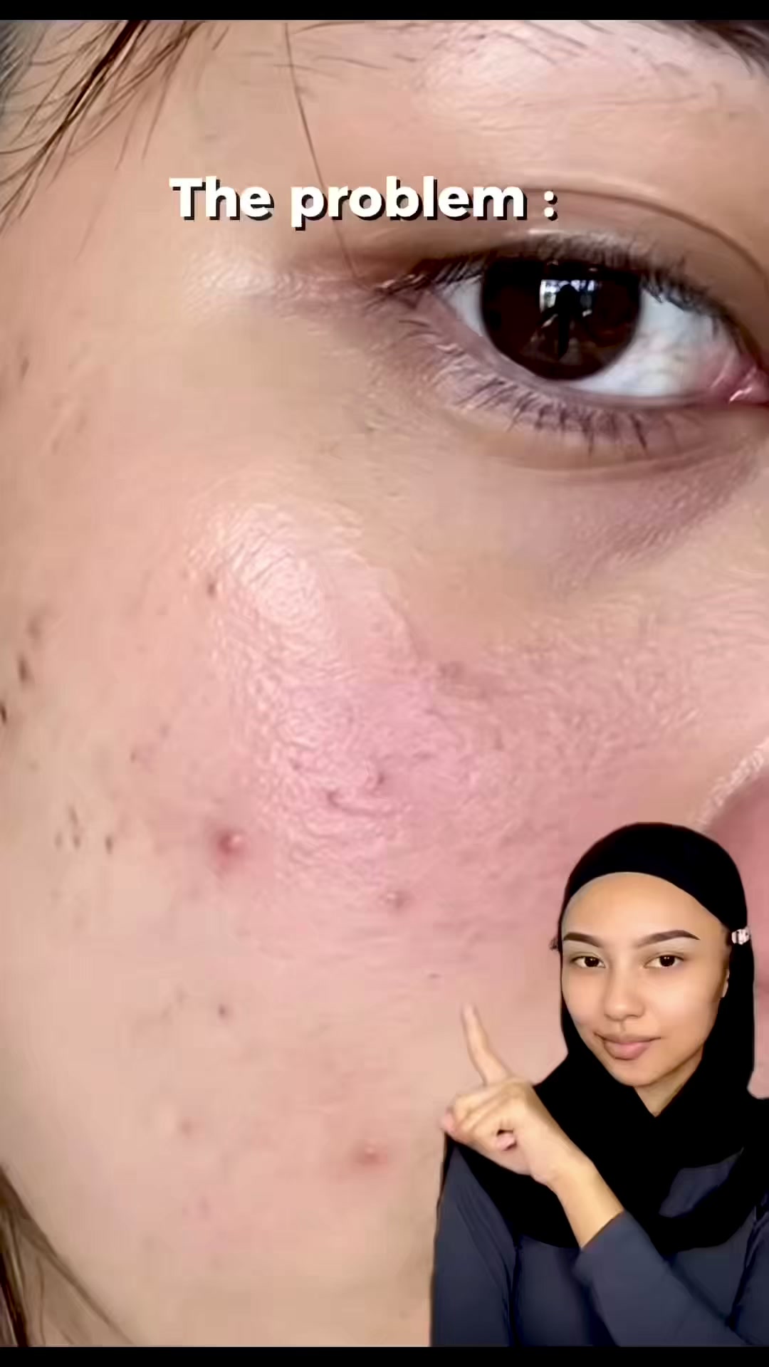 @audynapp