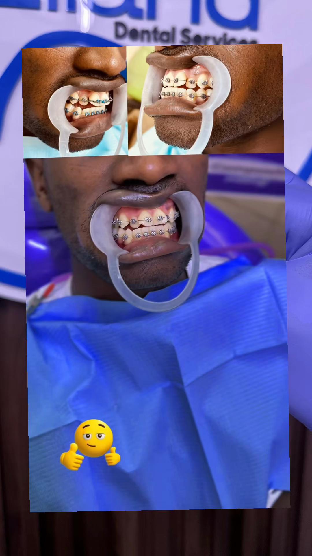 @Dr~MUJUNI 🦷🇺🇬✅