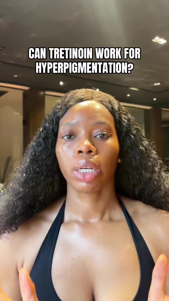 @BABYG🧝♀️🩷⭐️