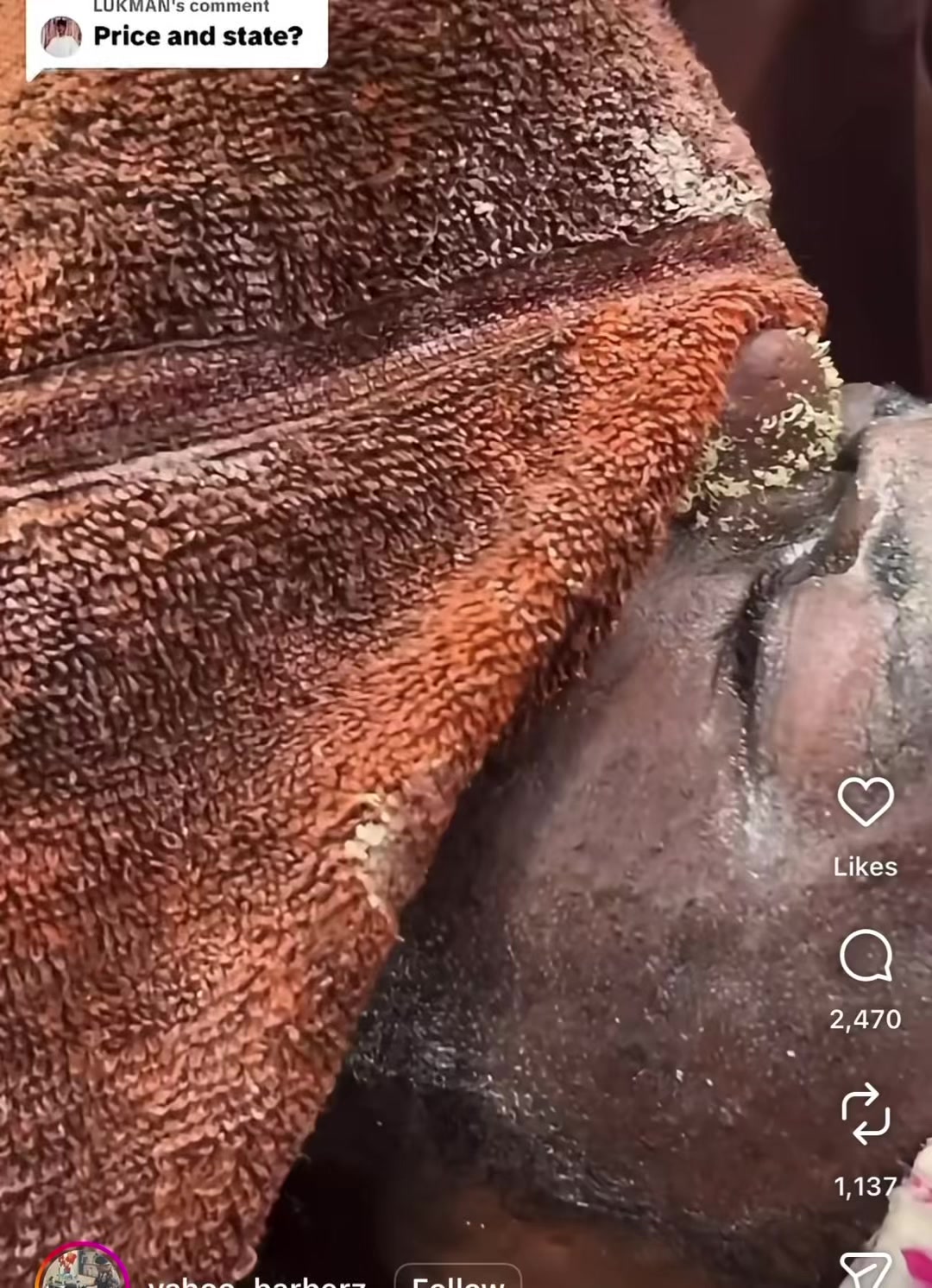 @Pure Skin OC
