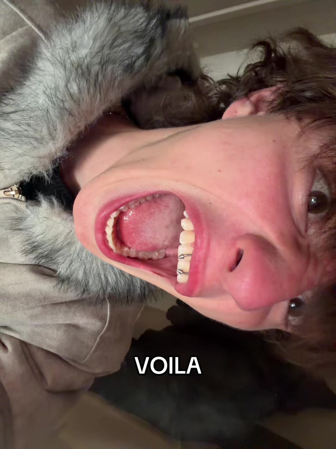 @dotttre