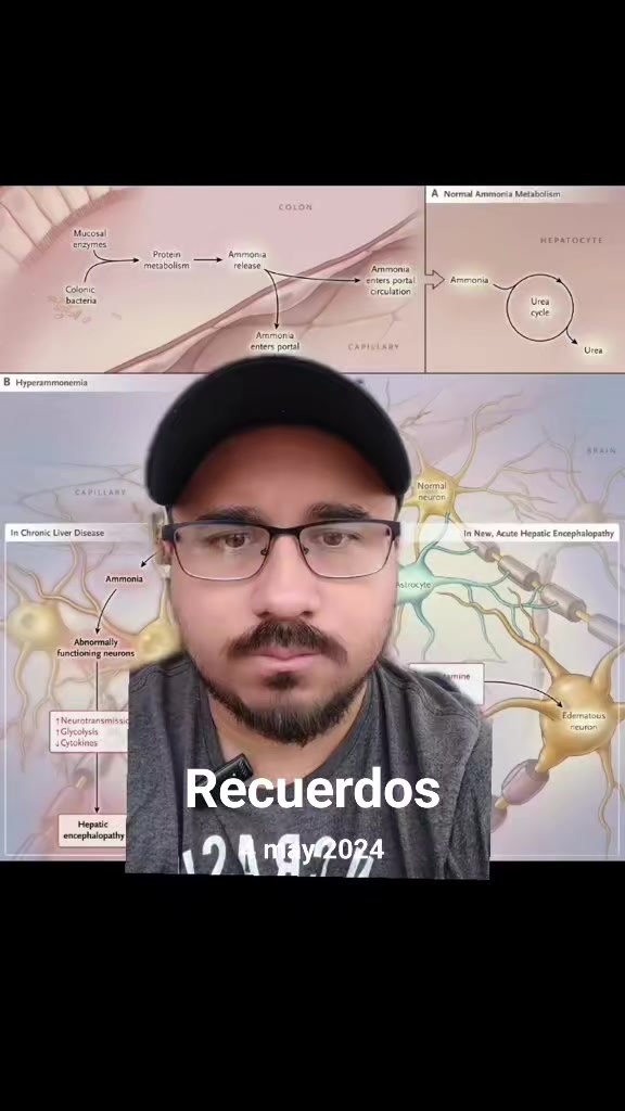 @Dr. Ajolote.