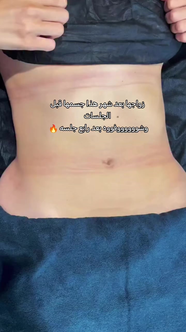 @body contour 🌱