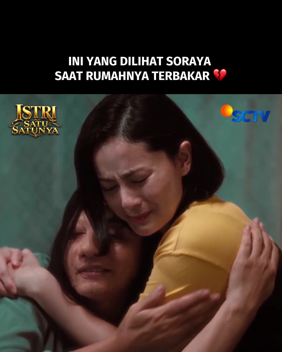@SCTV