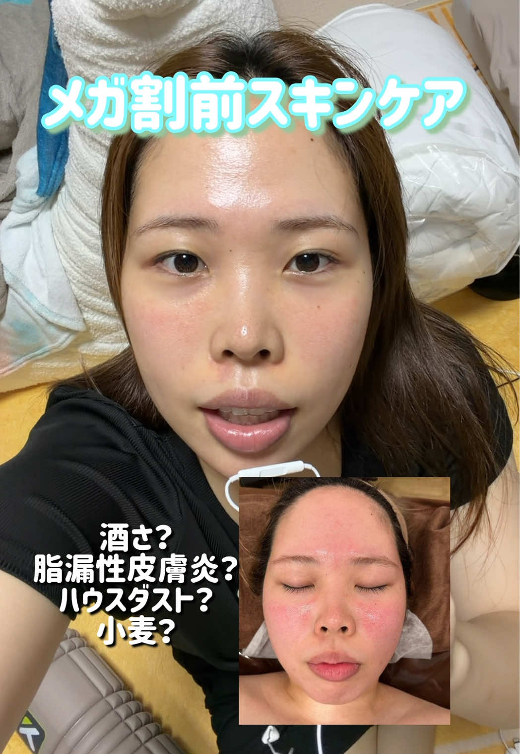 @アカネマディ