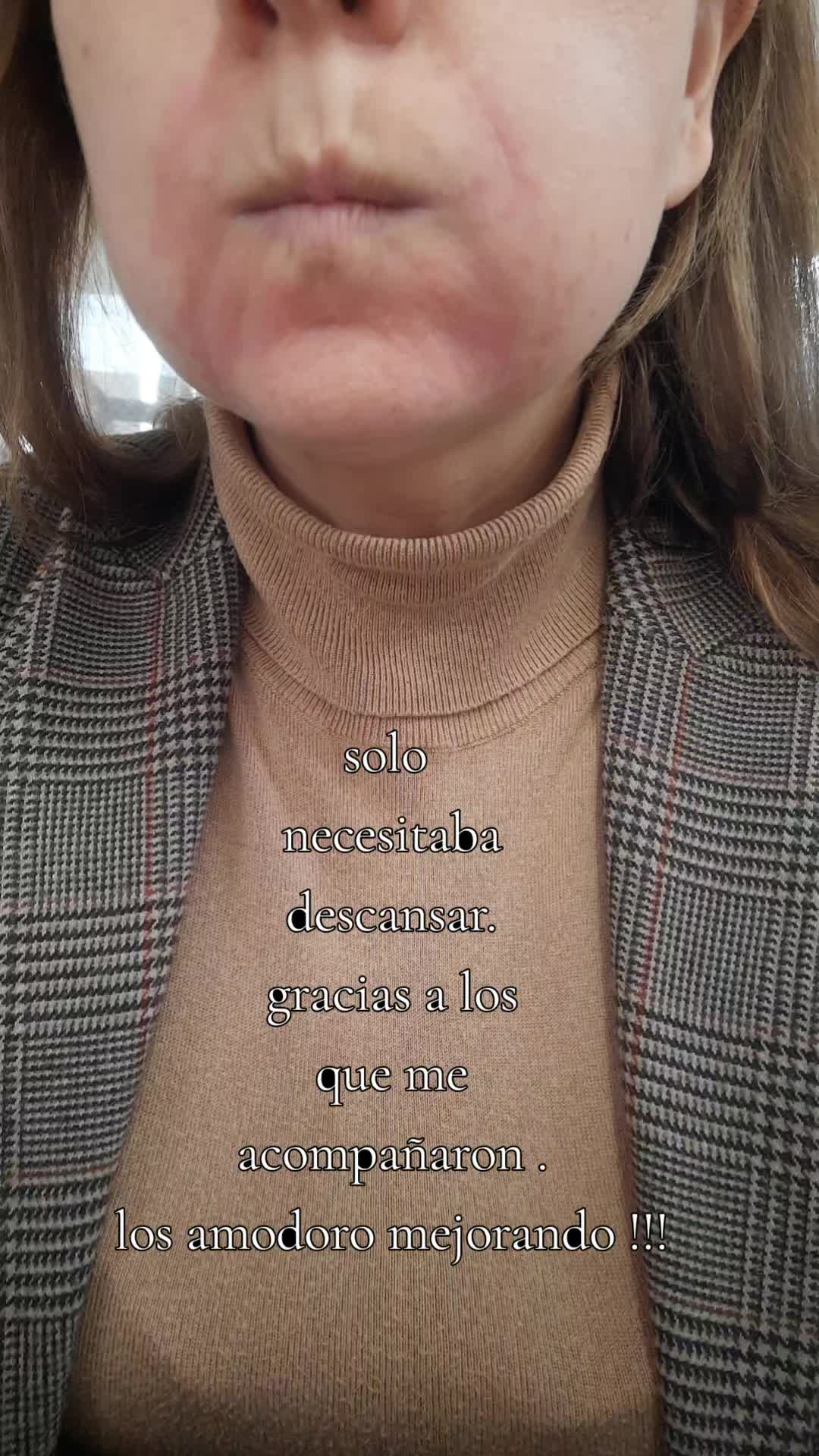 @Ale Arias