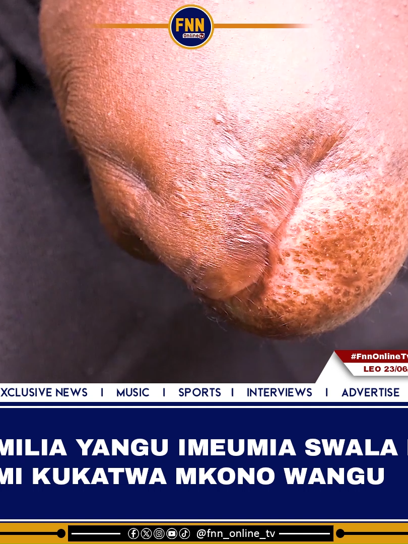 @FNN ONLINE TV