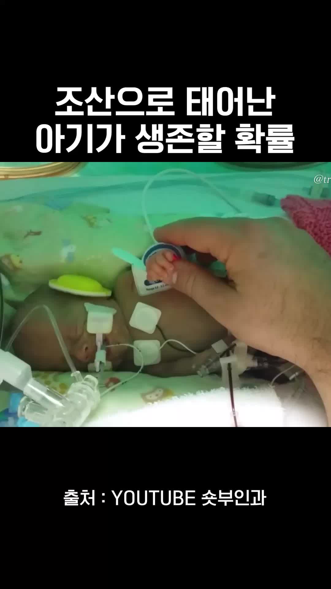 @와이퀸