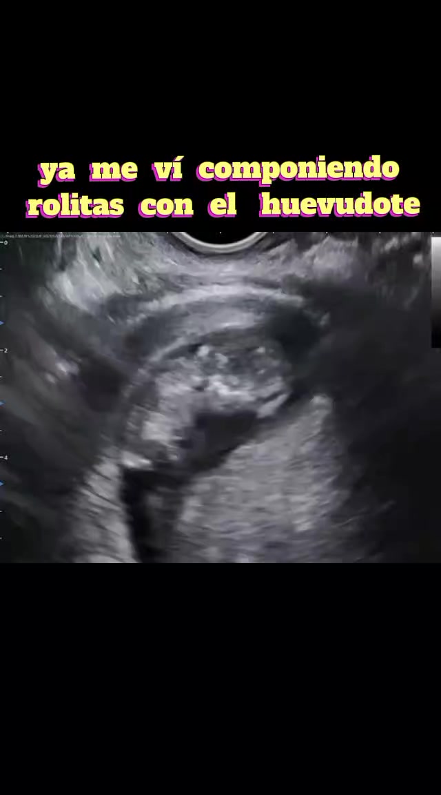 @Berny Briano Ortega 😎🇲🇽 🫡