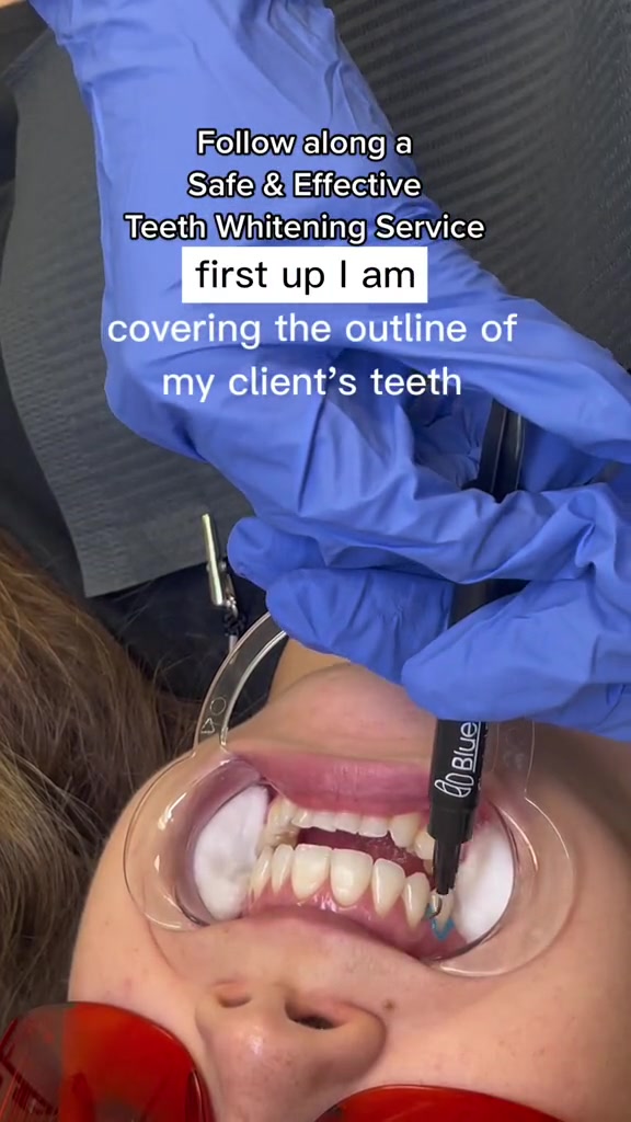 @Diandra | Teeth Whitening Tech