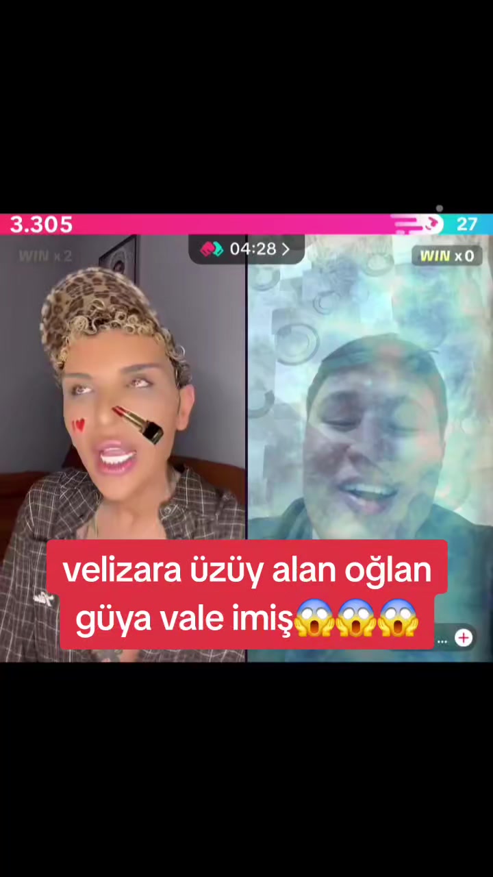 @🍓Çiyelek_Kayd🍓