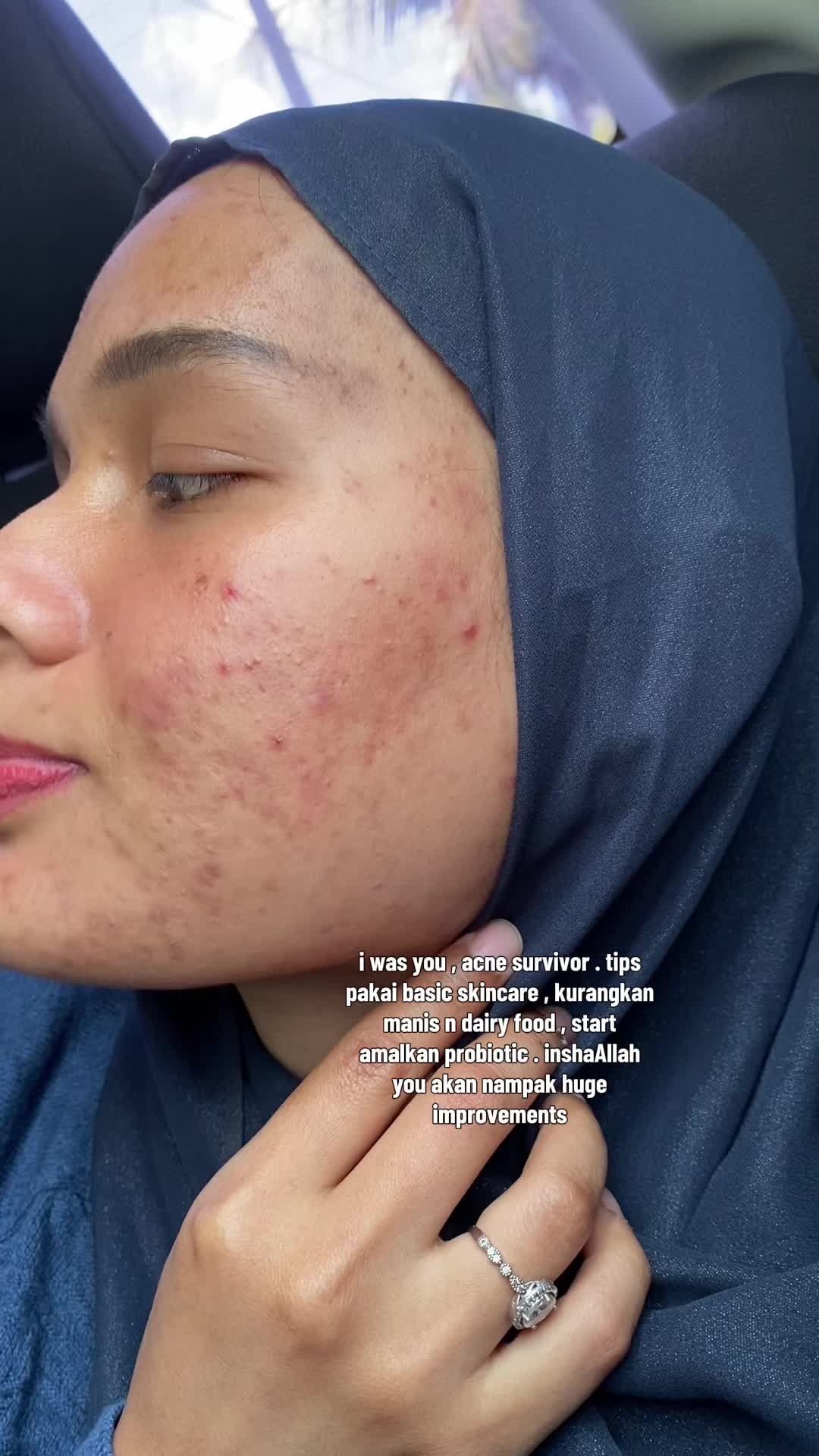 @aishhrahim