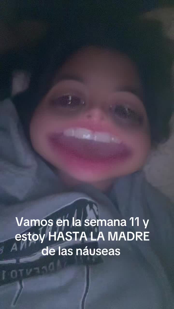 @Ale Acevedo