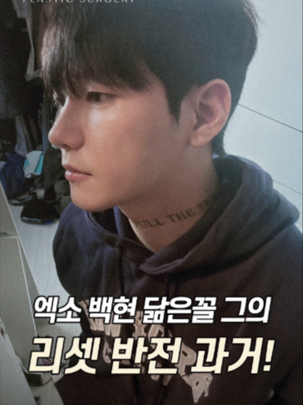 @리셋성형외과