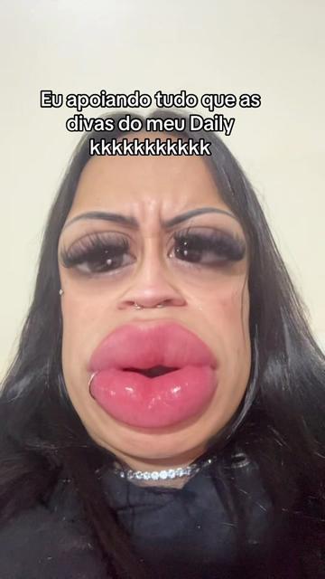 @Manuh Pimentel