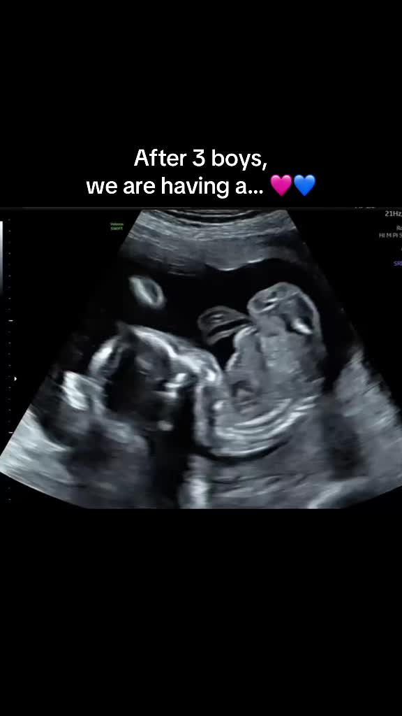 @alexg.rey 🧿
