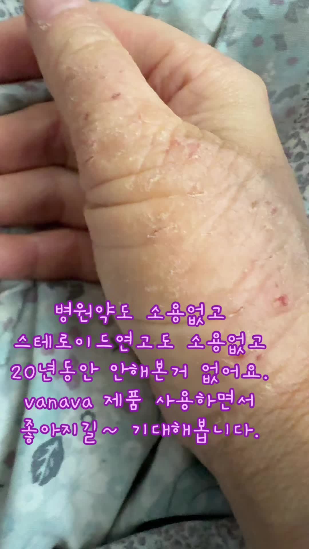 @은혜우체통(백향목)