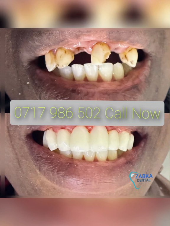 @Zabka Dental