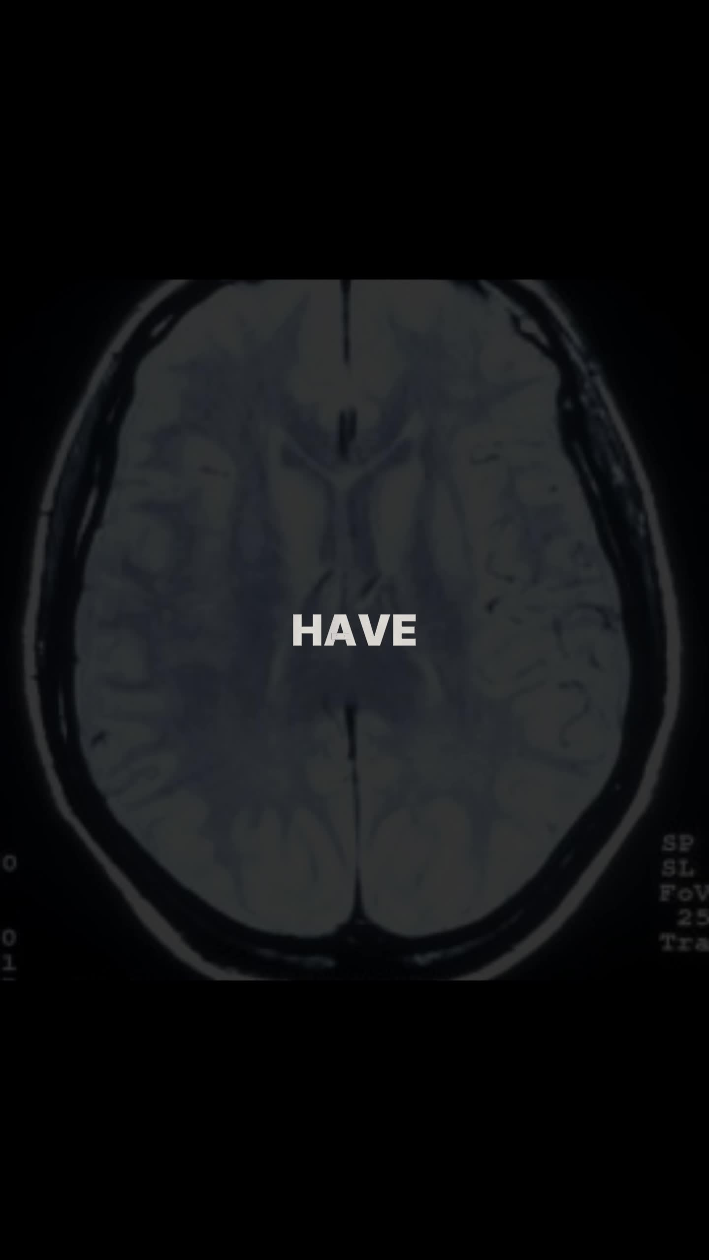 @NeuroWhisper