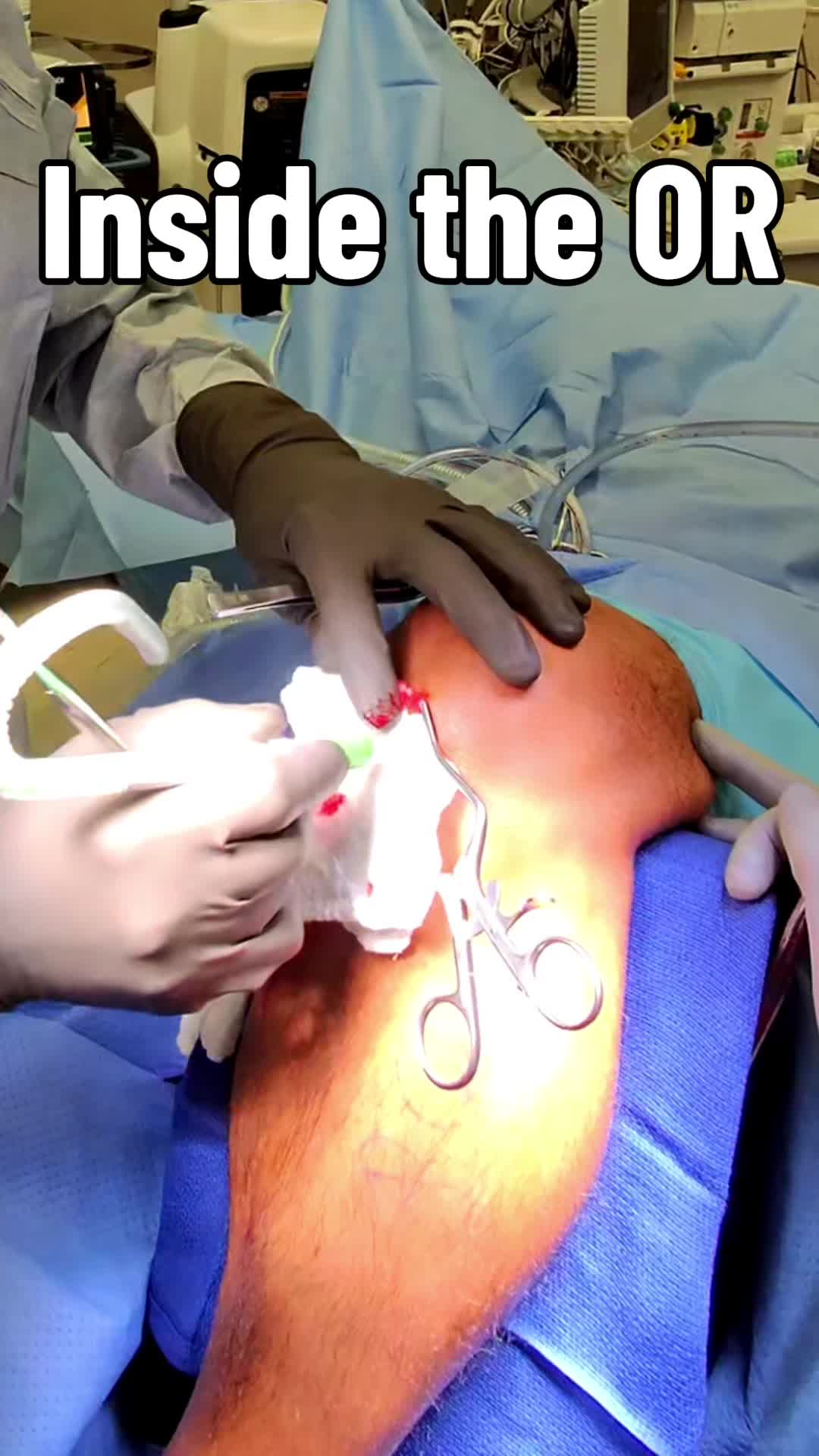 @Ortho POV