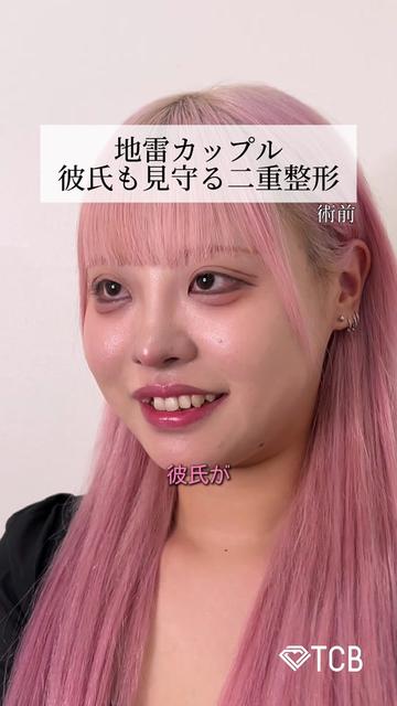 @【二重整形】TCB 新宿東口院ゆいこ先生/東京