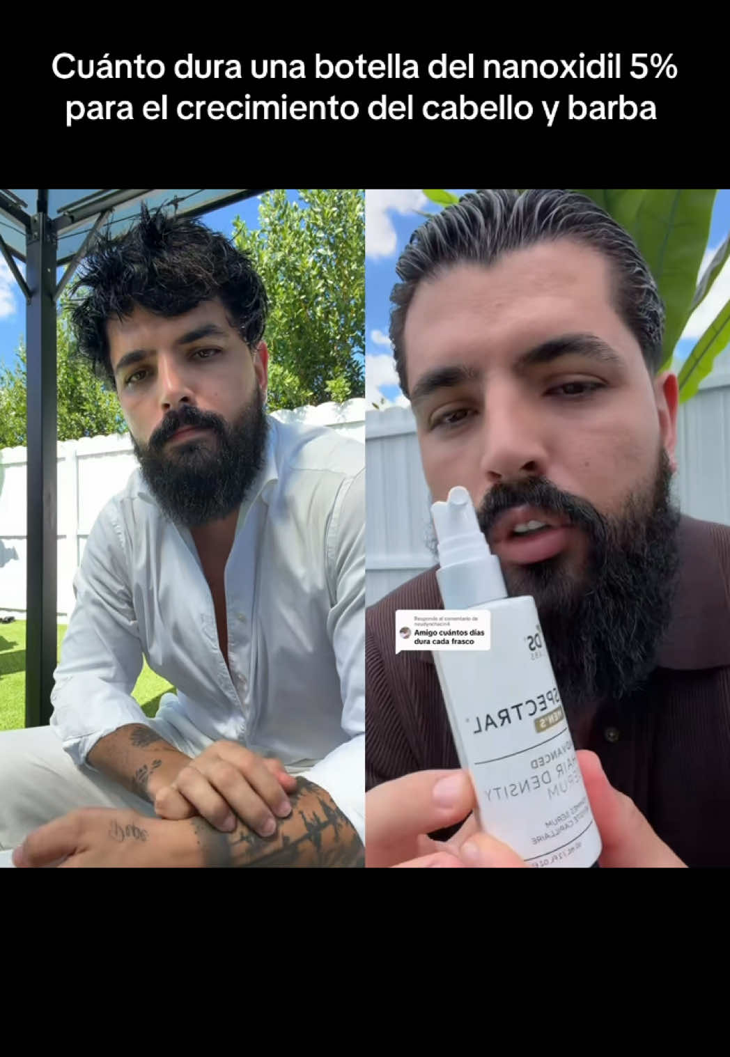 @Gonzalo Costa