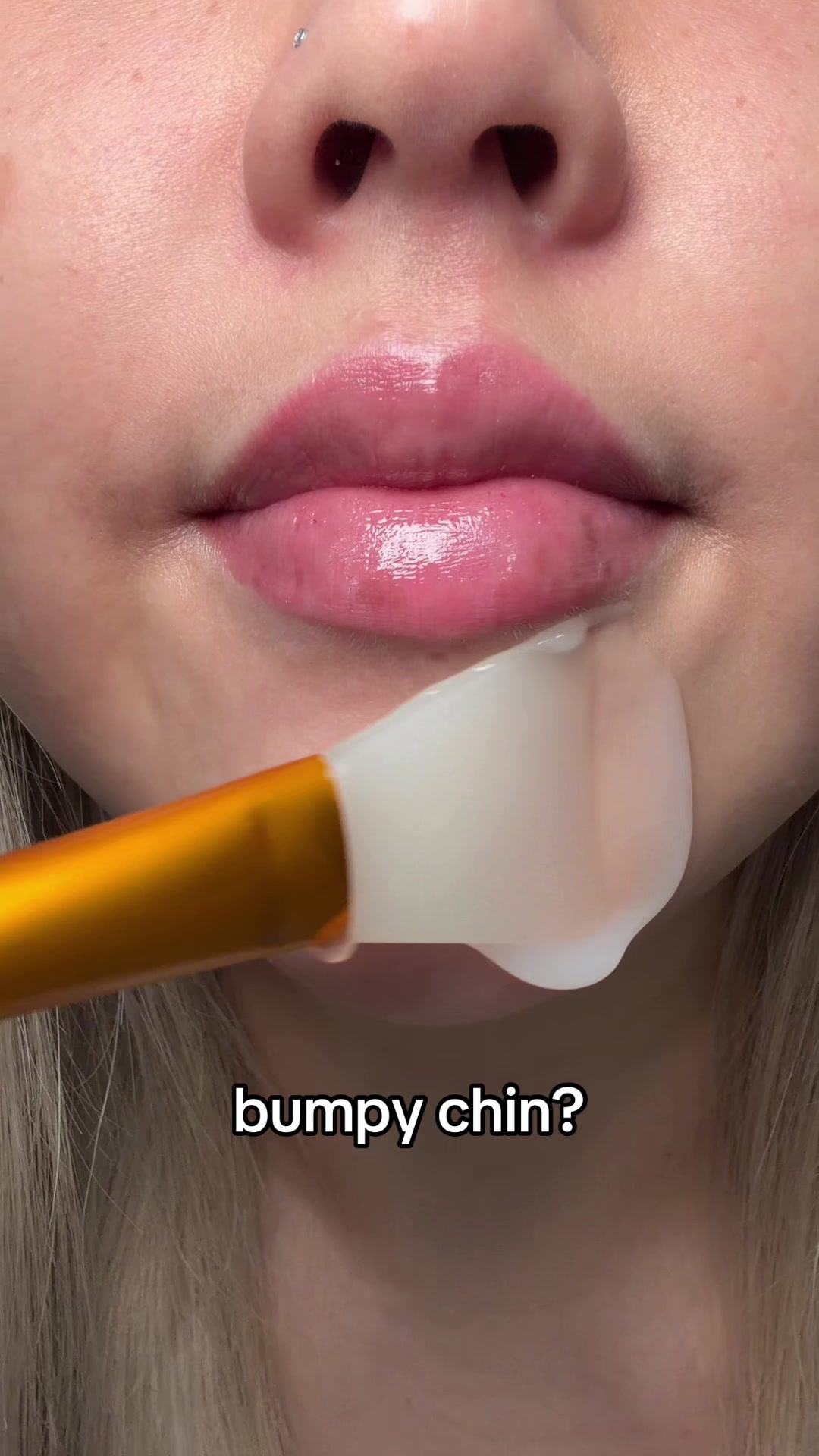 @Laura Bui