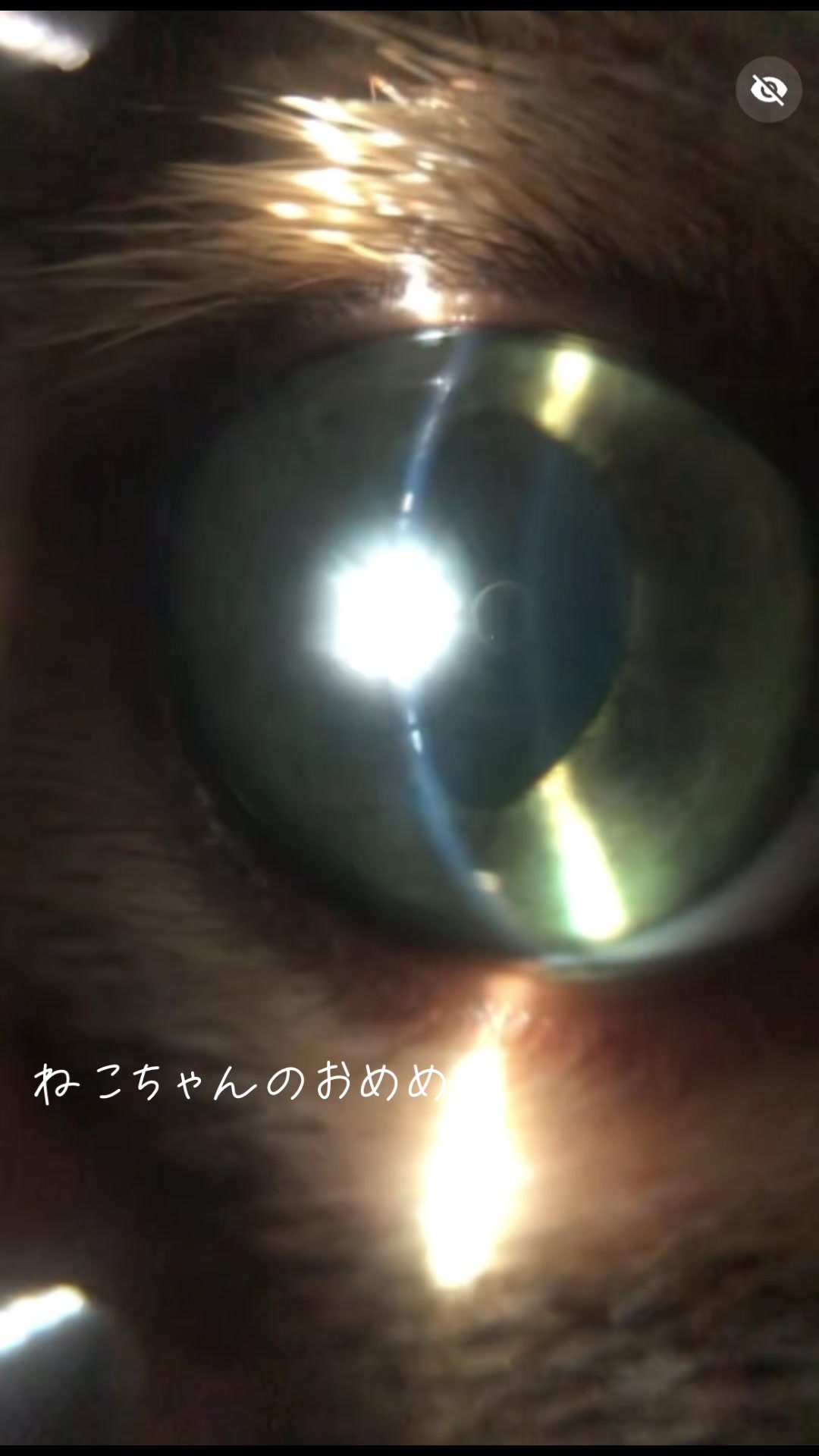 @Hiro|Orthoptist