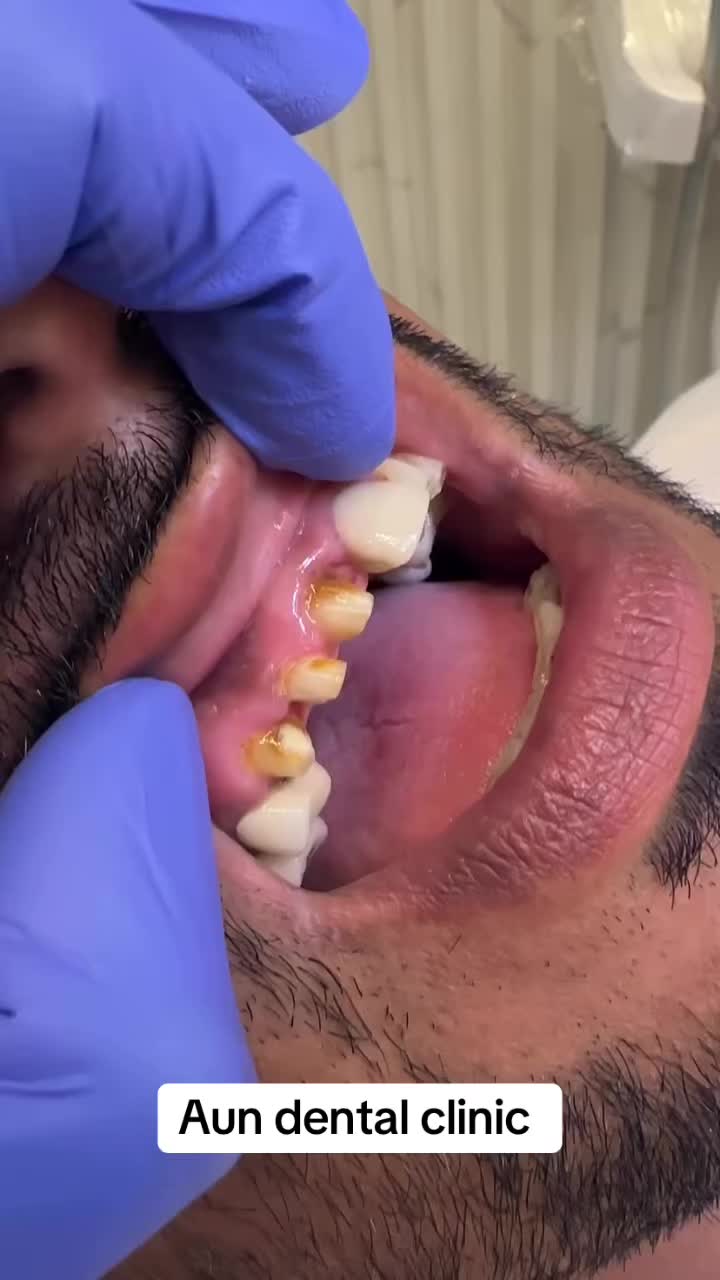 @Aun dental clinic ❤️