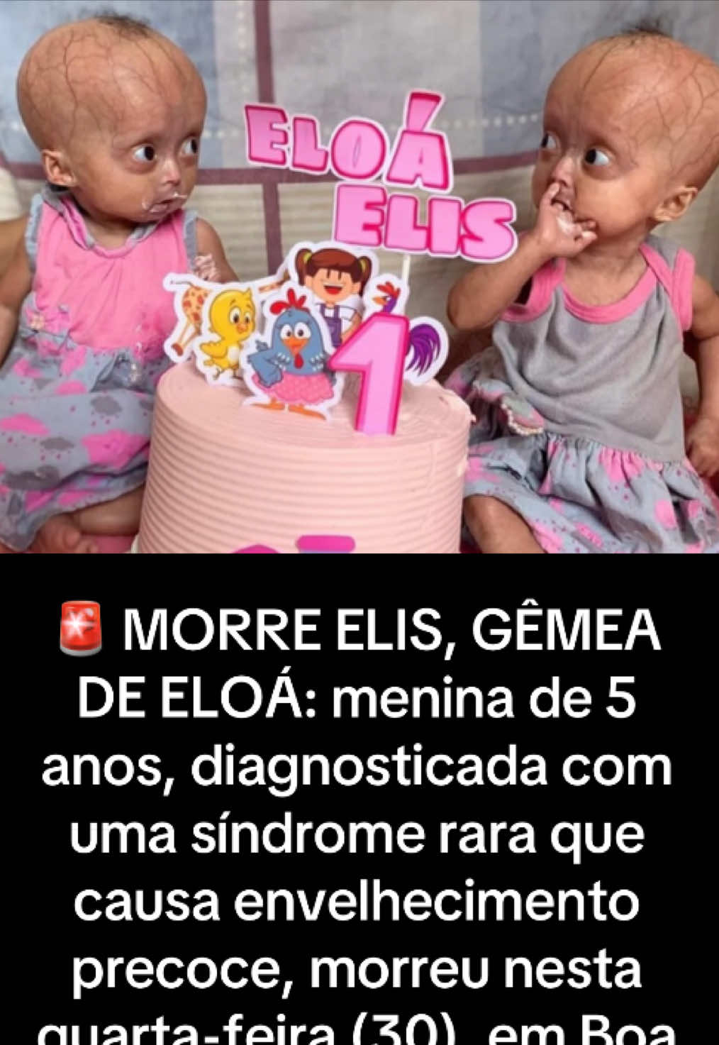 @Vish &eacute; treta