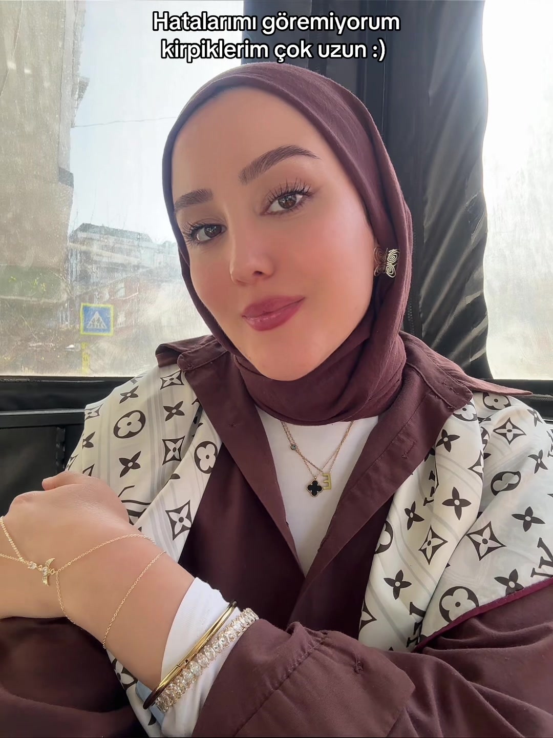 @Esra YILDIRIM
