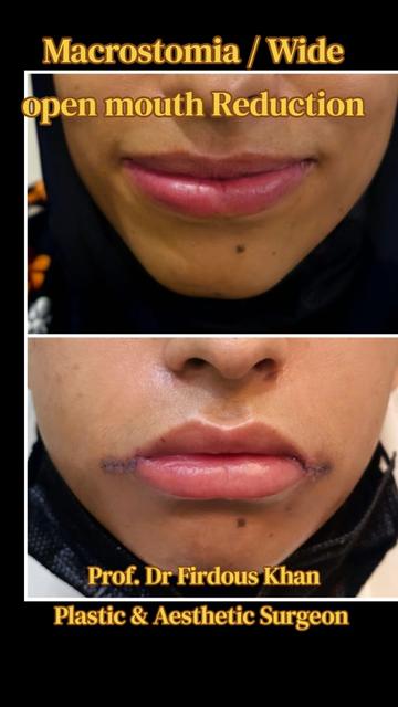 @Dr Firdous Khan PlasticSurgeon