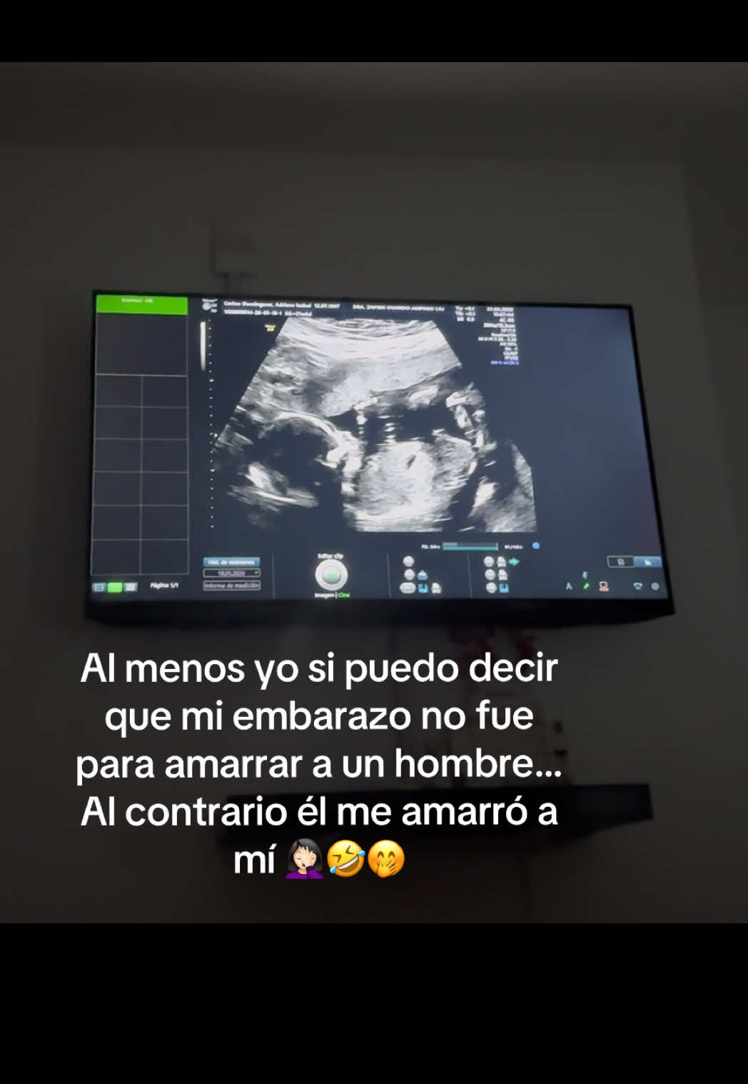 @Isacerino
