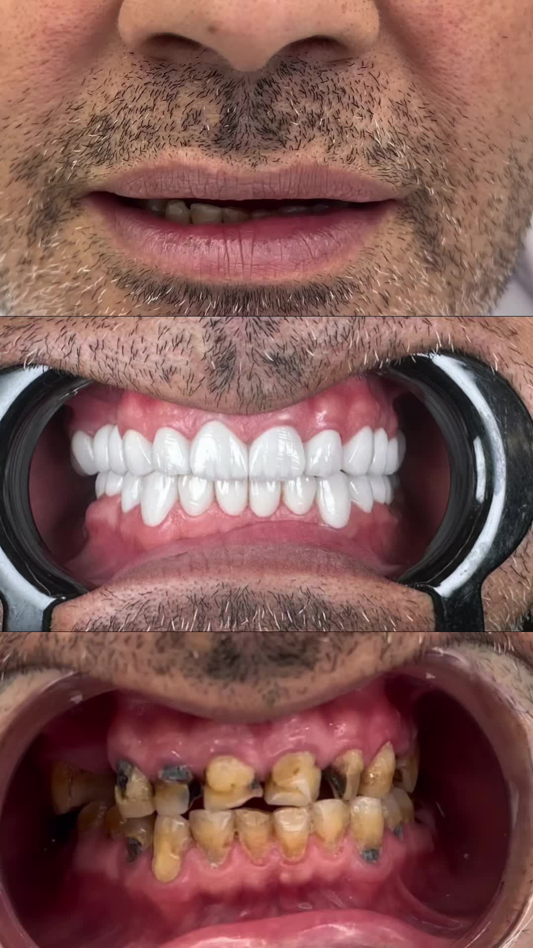 @پەرستارم 💉🩺