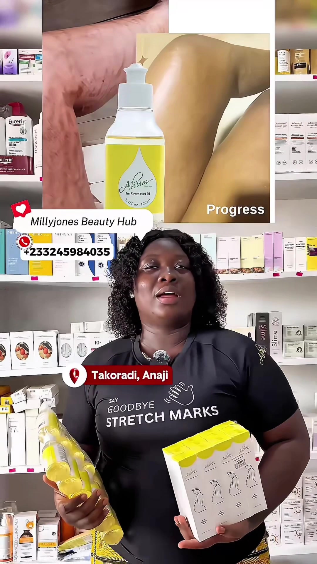 @No1 STRETCH MARKS PRODUCT