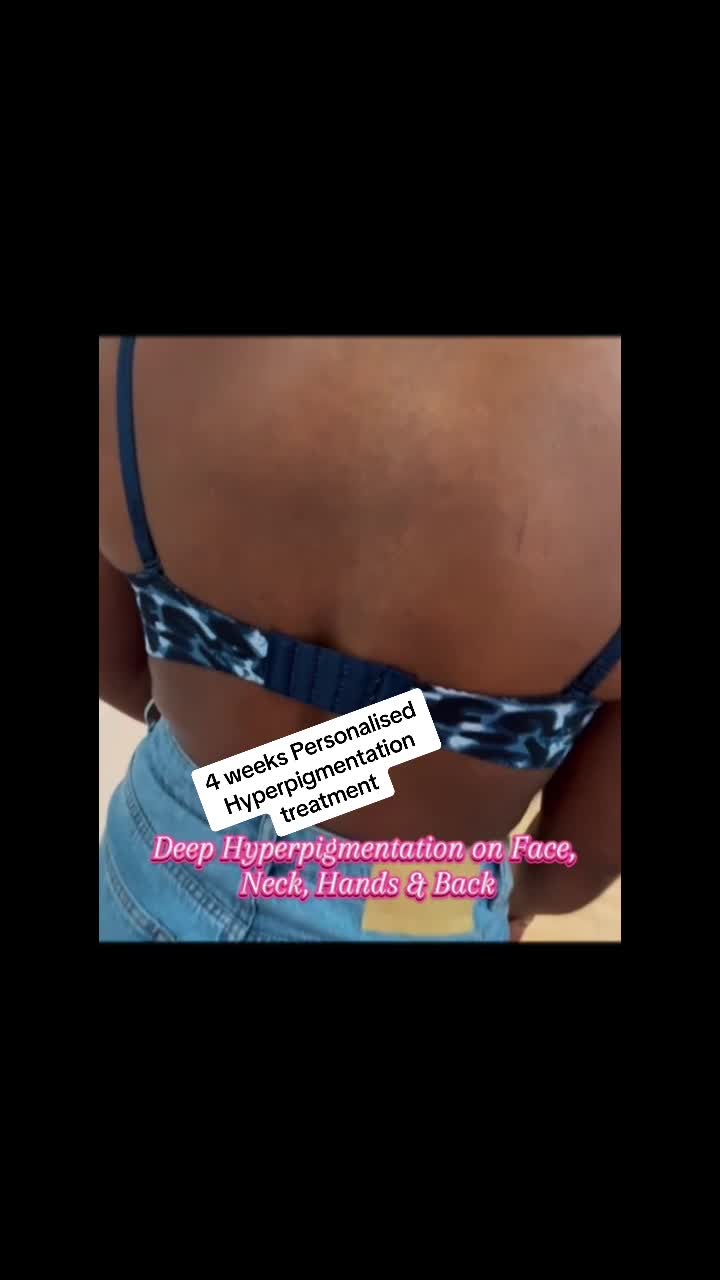 @LaBerry | Luxury Medspa Egbeda